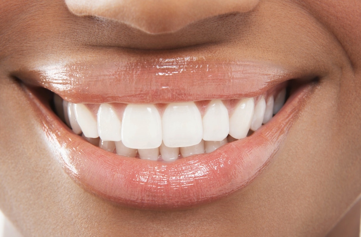 up close smile white teeth