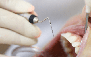 Dentist working on an open mouth, representing periodontal care