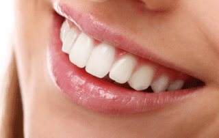 close-up of a woman's smile, representing oral health and overall health