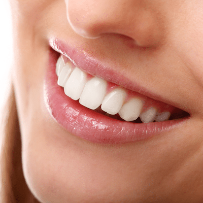 close-up of a woman's smile, representing oral health and overall health