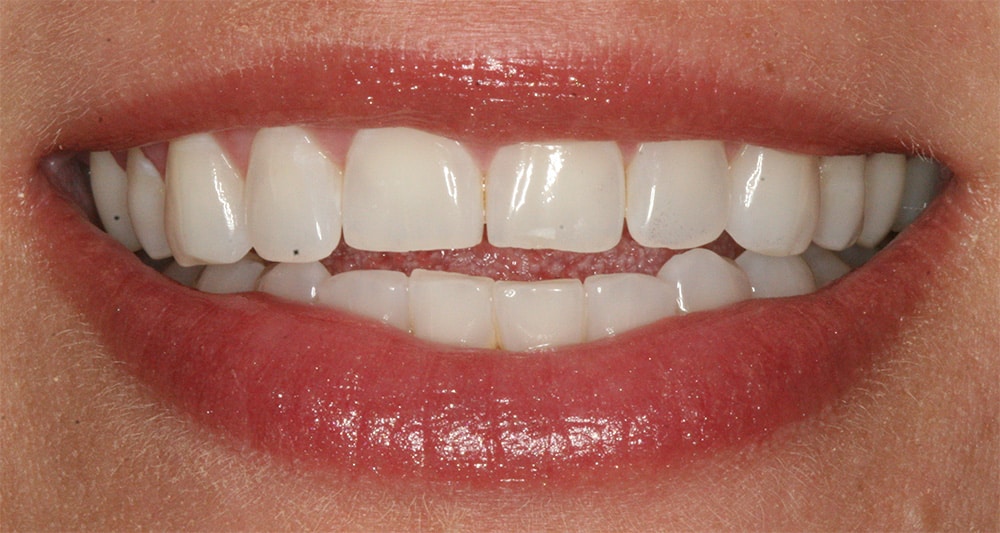 Patient smile before treatment