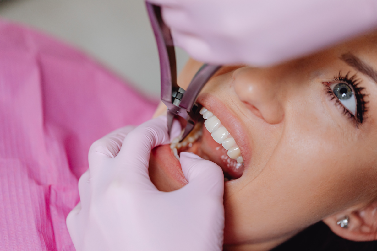 oral surgery in monroe