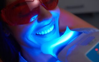 How Long Does Teeth Whitening Last After Treatment