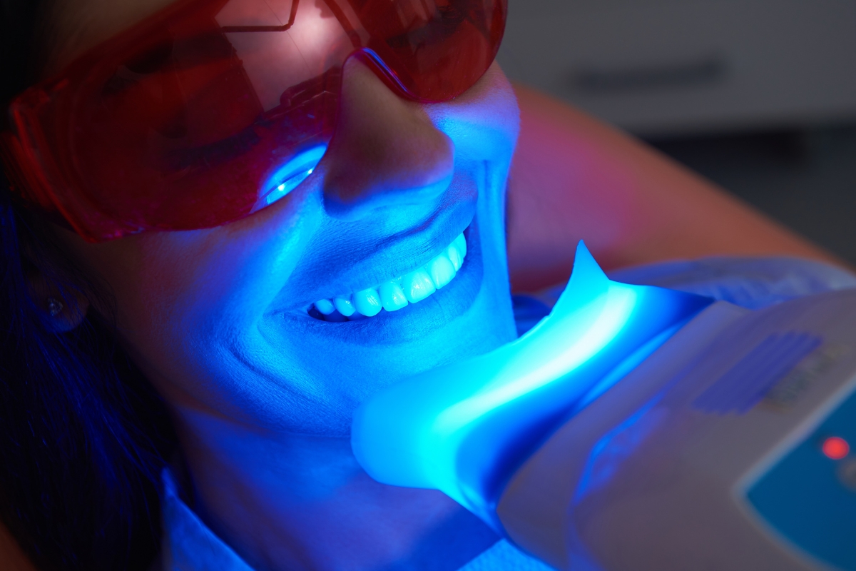 How Long Does Teeth Whitening Last After Treatment