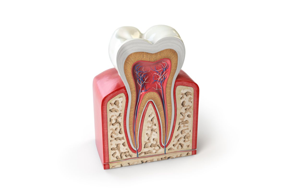 Root canal recovery